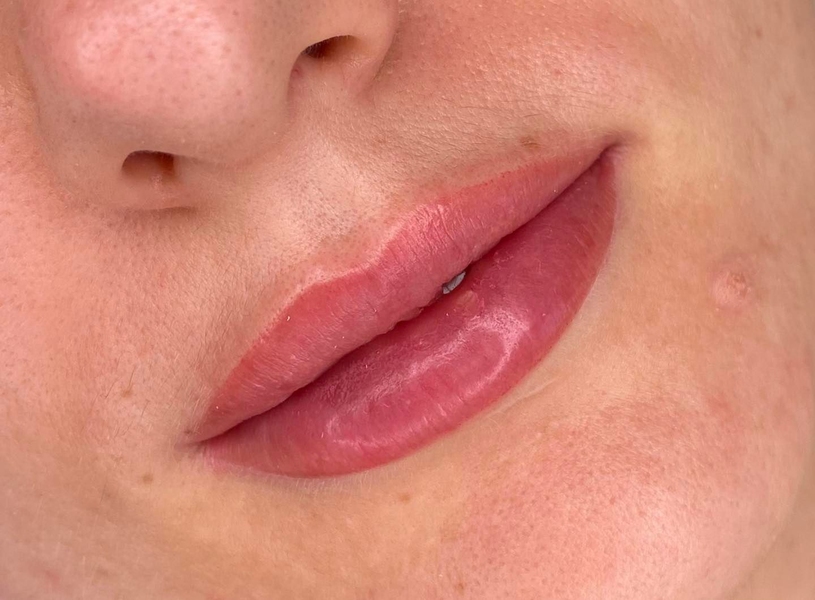 Lip micropigmentation