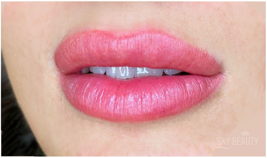 Lip micropigmentation