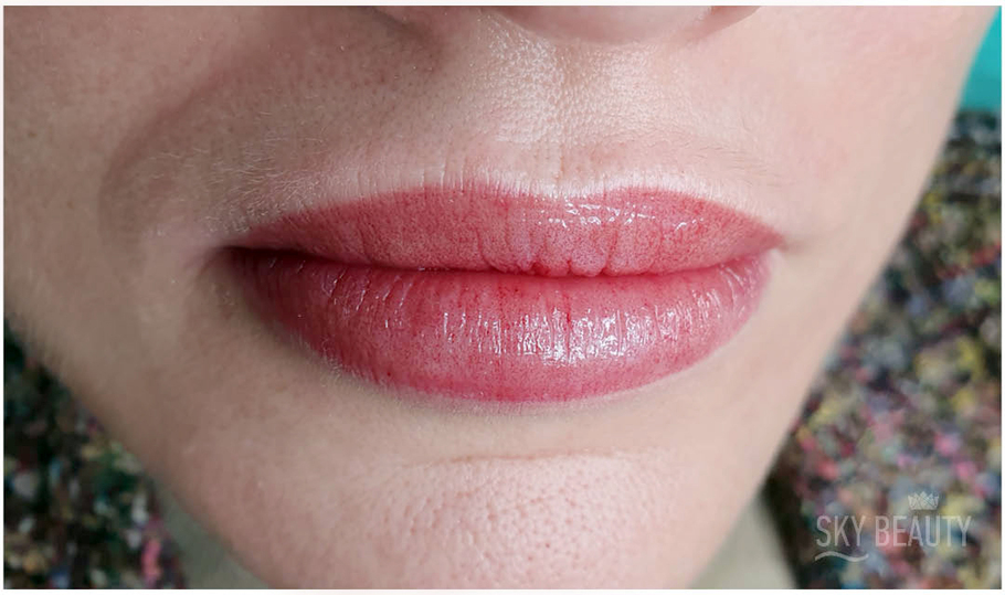 Lip micropigmentation