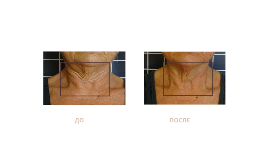 Advanced Face & Body skin care technologies ICOONE LASER