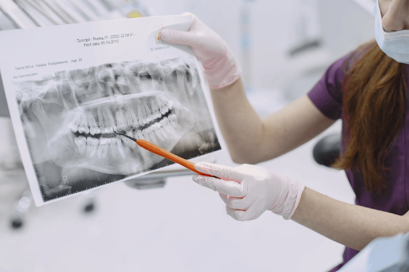 Почему важно регулярно проверять здоровье зубов?