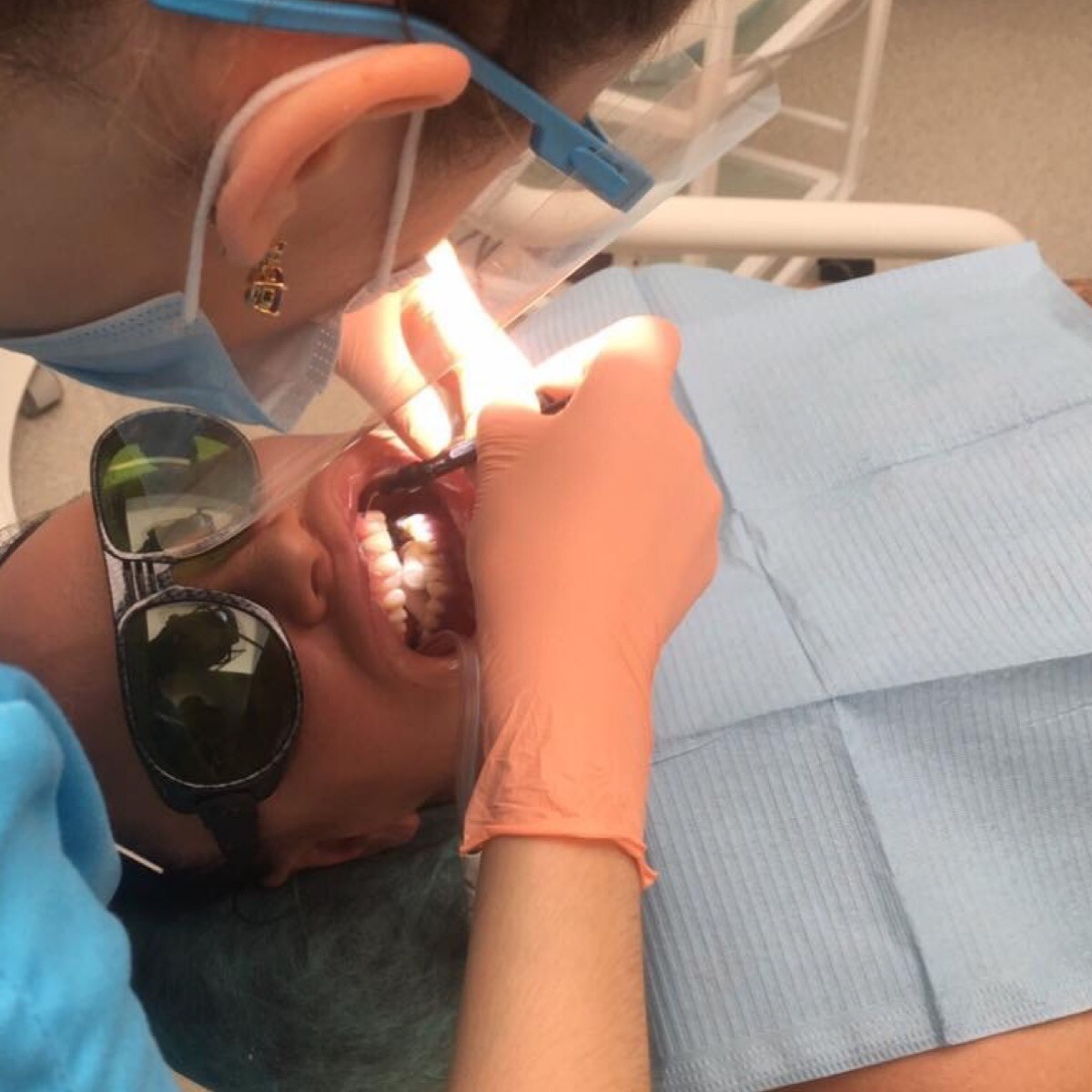 Отбеливание зубов с помощью Philips ZOOM WHITE SPEED