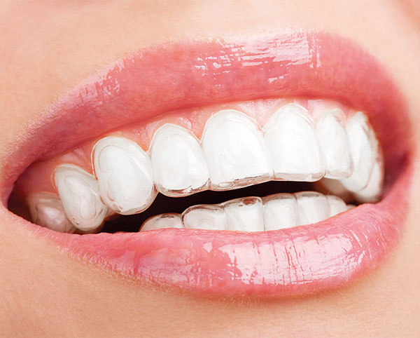 Стоматология в Риге Sky Dream Clinic – выбор современных людей!