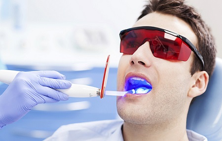 Лазерное отбеливание зубов — новые возможности эстетической стоматологии