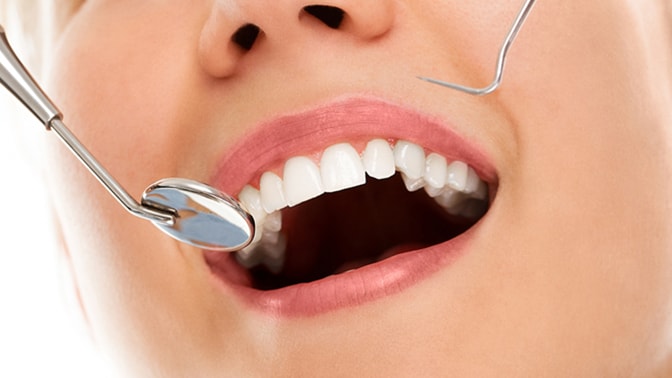 Металлокерамика. Особенности изготовления и установки протезов