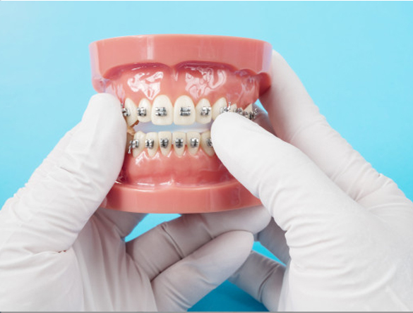 НОВИНКА! Теперь у нас свой ортодонт!