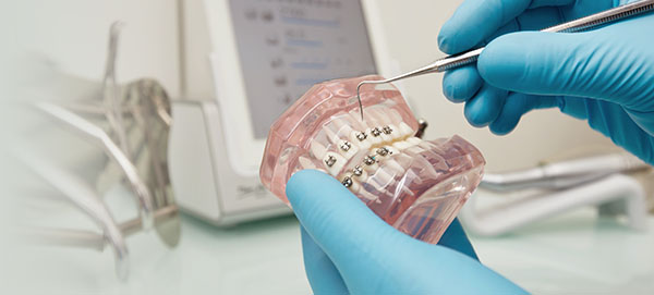 Исправление прикуса детям в Риге