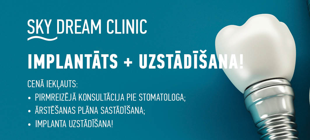Zobu implantāts + zobu kronis par AKCIJAS CENU 999€!