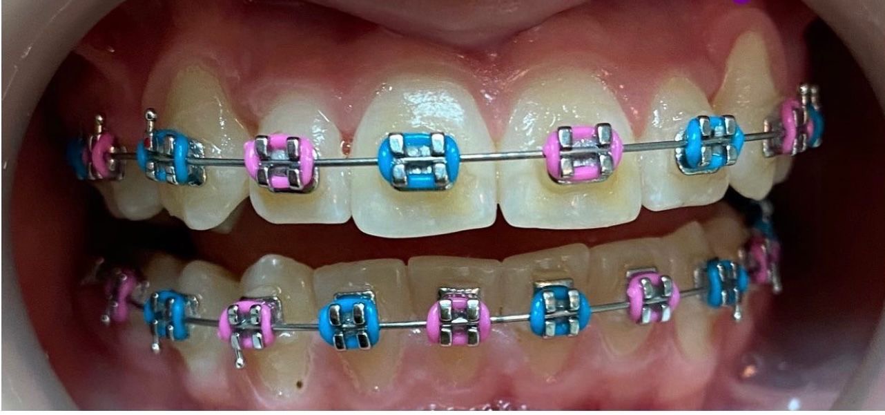 Отделение ортодонтии Nr.2 after