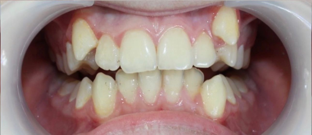 ortodontijas nodaļa Nr.1 before