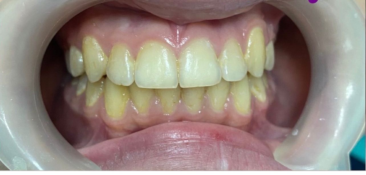 ortodontijas nodaļa Nr.1 after