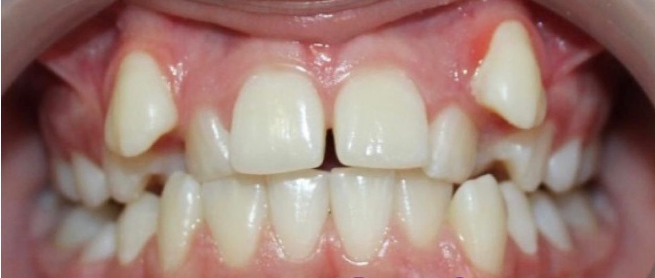 Отделение ортодонтии Nr.2 before