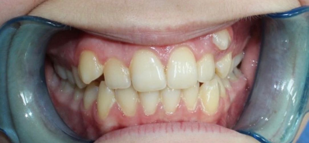 Отделение ортодонтии Nr.3 before