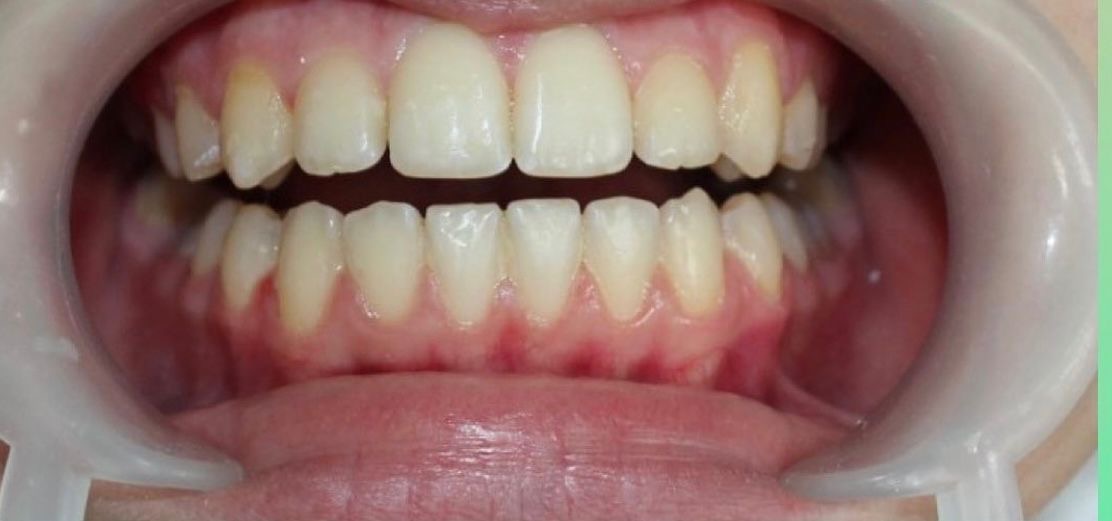 Отделение ортодонтии Nr.3 after