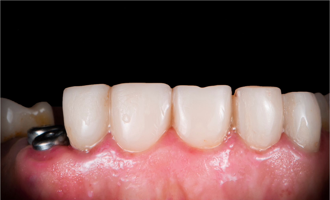 Viens zob im – 2 before