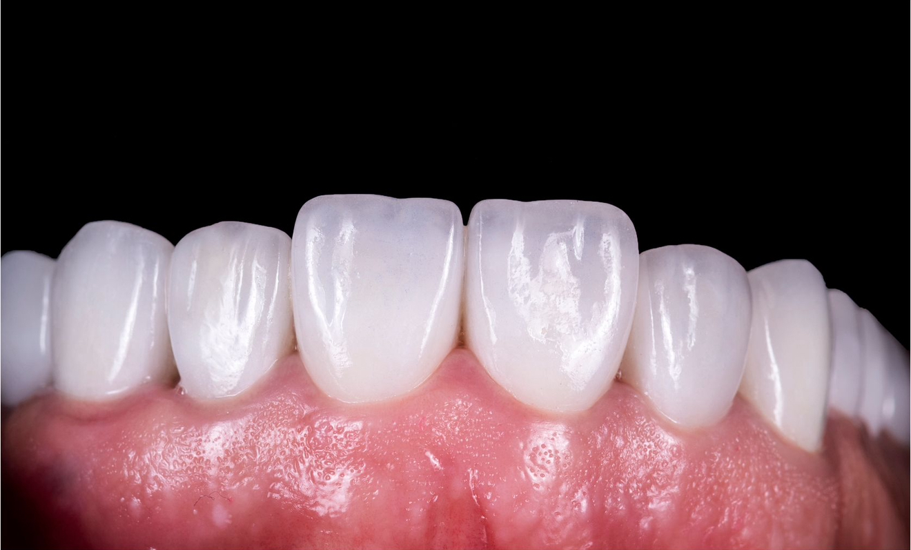 Viens zob im – 2 after