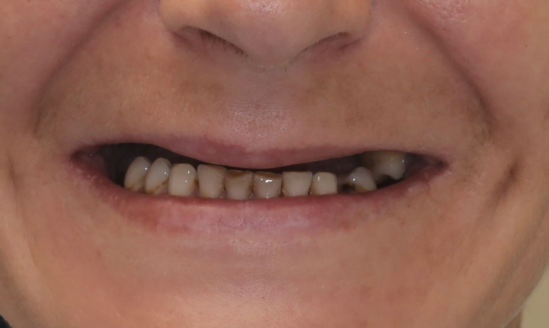 Viss uz 4 (2026) before