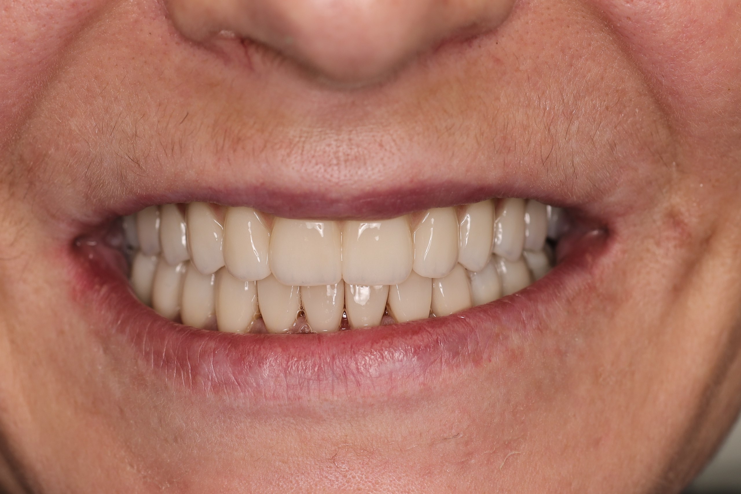 Viss uz 4 (2026) after