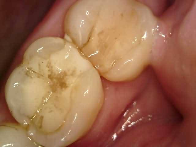 Arina 2 before